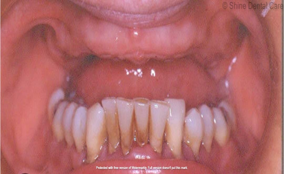 case 2