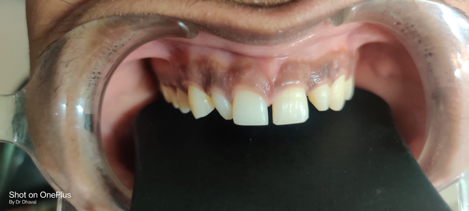 case 9