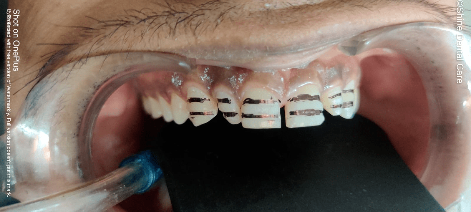 case 10